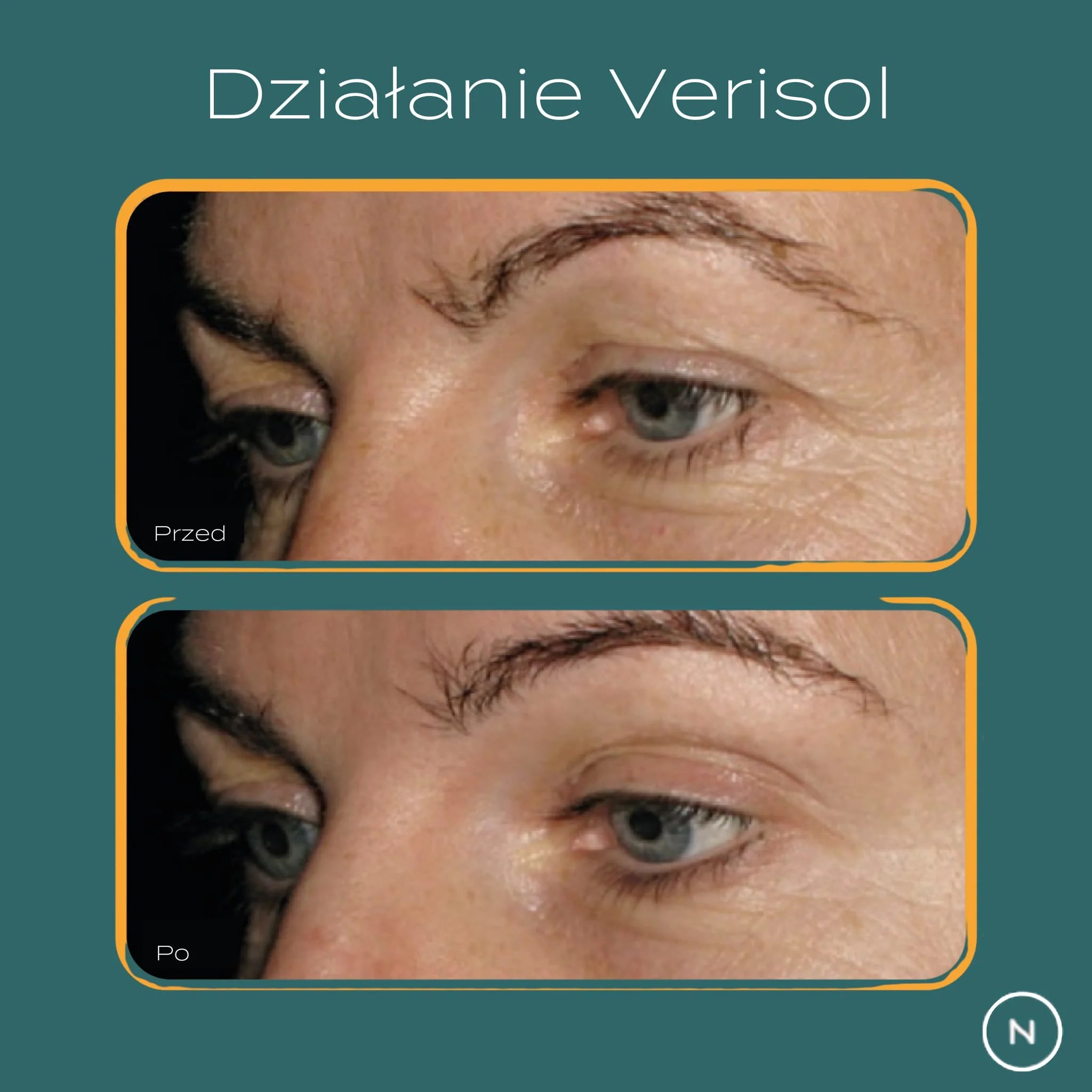 dzialanie verisol